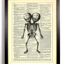 Image of Siamese Twins Skeleton, Vintage Dictionary Print, 8 x 10